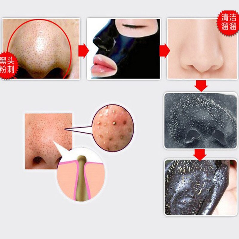 Black Face Patch Nose Strips Remove Blackheads Pores Black Head Remover Acne Peel Mask Black Dots Cleaning Medical Plaster 1bag Main image