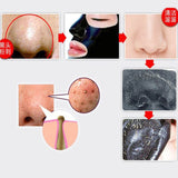 1bag Black Face Patch Nose Strips Remove Blackheads Pores Black Head Remover Acne Peel Mask Black Dots Cleaning Medical Plaster