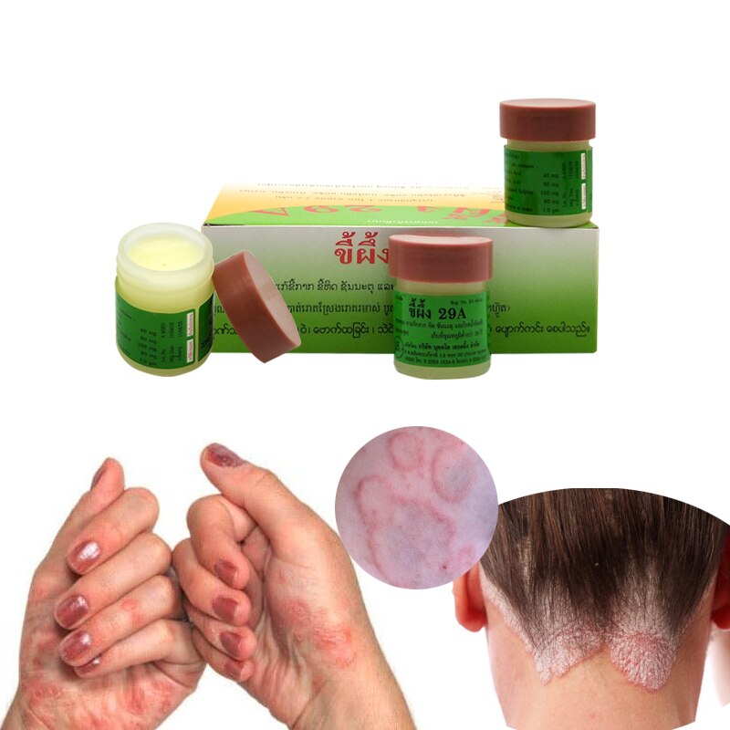 1pc Psoriasis Eczma Cream Works Perfect For All Kinds Of Skin Problems Patch Body Massage Ointment Chinese Medicine