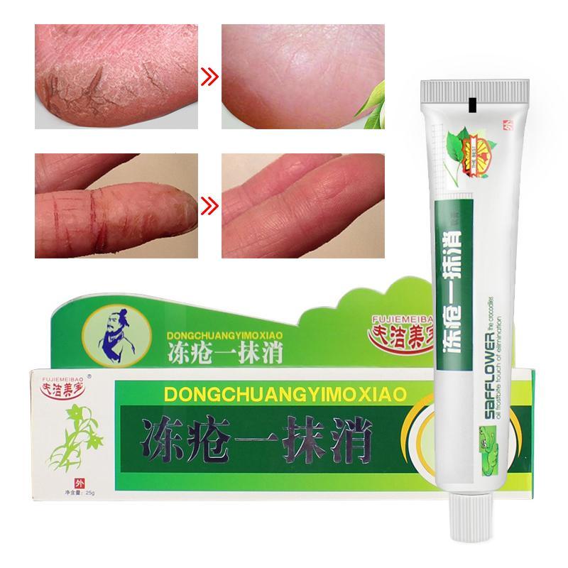 Powerful Chinese Medicinal Ointment Hand Foot Crack Cream Heel Chapped Peeling Repair Frostbite Anti Dry Crack Skin Creams Main image