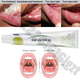 Mouth Ulcer Relief Gel Natural Herbal Oral Antibacterial Cream Fast Relief from Severe Pain & Irritation within 2 minutes