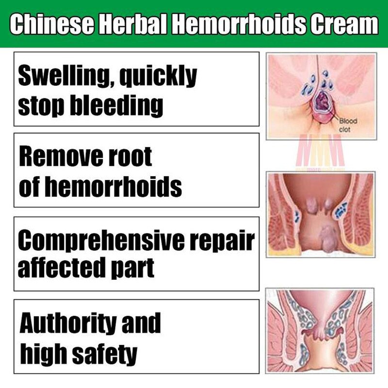 20g Hua Tuo Herbal Hemorrhoids Cream Effective Treatment Internal Hemorrhoids Piles External Anal Fissure Secondary image