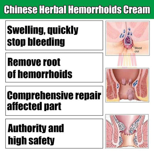 20g Hua Tuo Herbal Hemorrhoids Cream Effective Treatment Internal Hemorrhoids Piles External Anal Fissure