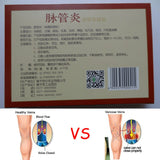 24 Pcs Spider Veins Varicose Treatment Plaster Varicose Veins Cure Patch Vasculitis Natural Solution Herbal Patches