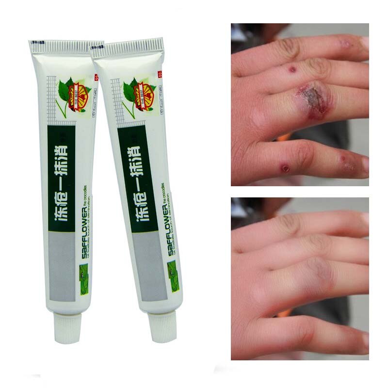 Chinese Medicinal Ointment Hand Foot Crack Cream Heel Chapped Peeling Repair Frostbite Anti Dry Crack Skin Creams Wholesale Main image
