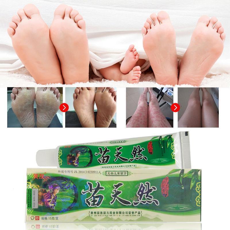 New Miao natural bacteriostatic ointment hemorrhoids Gels herbal Body Psoriasis Cream Plasters with Retail Box Skin Care 15g Main image