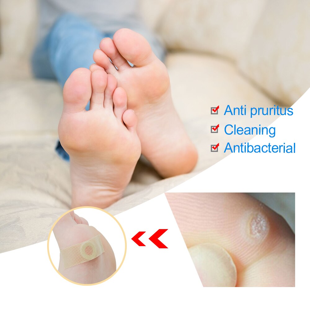 42Pcs Painless Feet Care Foot Medical Corn Remover Warts Thorn Plaster Callus Removal Tool Soften Skin Cutin K03401