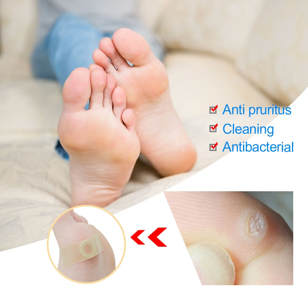 Painless Feet Care Foot Medical Corn Remover Warts Thorn Plaster Callus Removal Tool Soften Skin Cutin K03401 42Pcs Main image