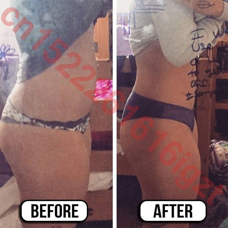 Slimming Cellulite Removal Cream Fat Burner Weight Loss Slimming Creams Leg Body Waist Effective Anti Cellulite Fat Burning Secondary image