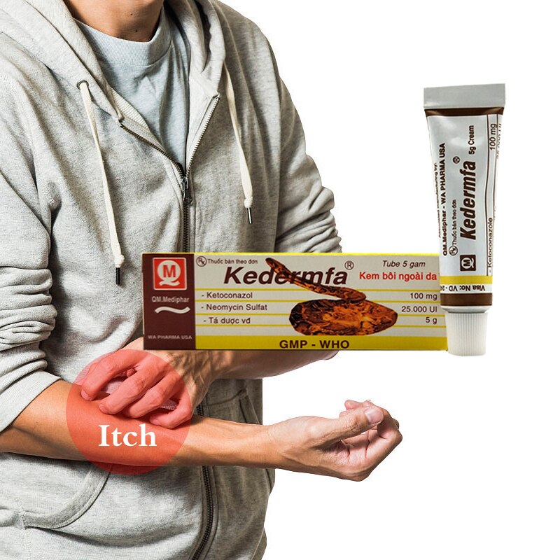 Profession Snake Oil itching ointment Remove Scar cream Striae Gravidarum Pigmentation Acne burn cream natural herbal plaster Main image