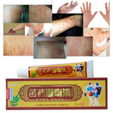 Body Psoriasis Cream Ointment with Retail Box Skin Care Chinese Ointment Cream For All Kinds Of Skin Problems Plaster