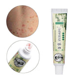 Zudaifu Cream Psoriasis Cream Skin Care Psoriasis Skin Dropshipping Dermatitis Eczematoid Eczema Ointment Treatment Care Cream