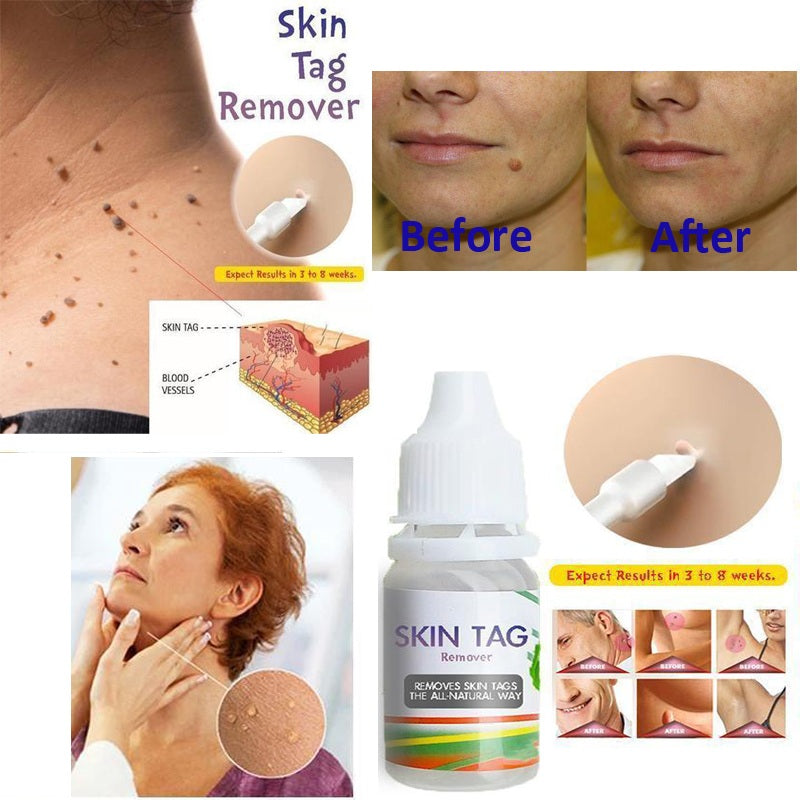 10ML Body Warts Treatment Cream Skin Tag Remover Foot Corn Removal Plantar Genital Warts Ointment Foot Care Cream Dropshopping Main image