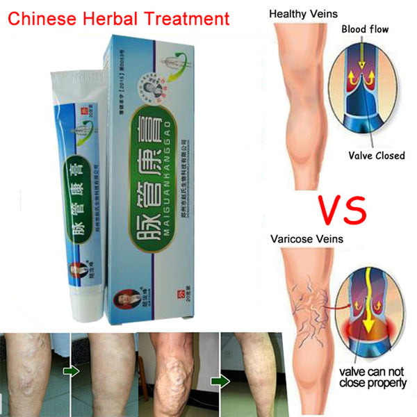 Varicose Veins ointment eins Varicose Treatment Plaster Varicose Veins Cure Patch Vasculitis Natural Solution Herbal Patches