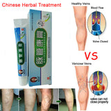Varicose Veins ointment eins Varicose Treatment Plaster Varicose Veins Cure Patch Vasculitis Natural Solution Herbal Patches