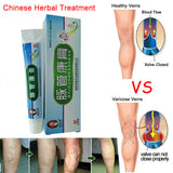 Varicose Veins ointment eins Varicose Treatment Plaster Varicose Veins Cure Patch Vasculitis Natural Solution Herbal Patches