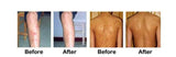 New Body Psoriasis Cream For Dermatitis and Eczema Pruritus Psoriasis Ointment Herbal Creams Skin Care Health Patches