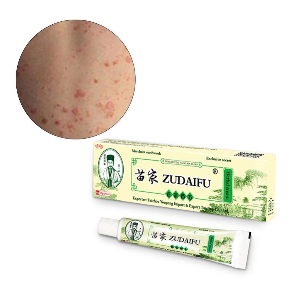 Zudaifu Skin Care Cream Skin Psoriasis Cream Dermatitis Eczematoid Eczema Ointment Treatment Psoriasis Cream