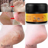 Horse Oil Foot Hand Antifreeze Cream Treatment Dry Skin Heel Chapped Peeling Repair Anti Chapping Wrinkle Treatment Ointment