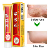 Powerful Hand Foot Crack Cream Heel Chapped Peeling Foot and Hand Repair Anti Chapping Wrinkle Treatment Skin Cracking