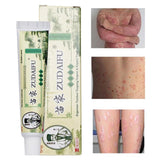 Zudaifu Cream Psoriasis Cream Skin Care Psoriasis Skin Dropshipping Dermatitis Eczematoid Eczema Ointment Treatment Care Cream