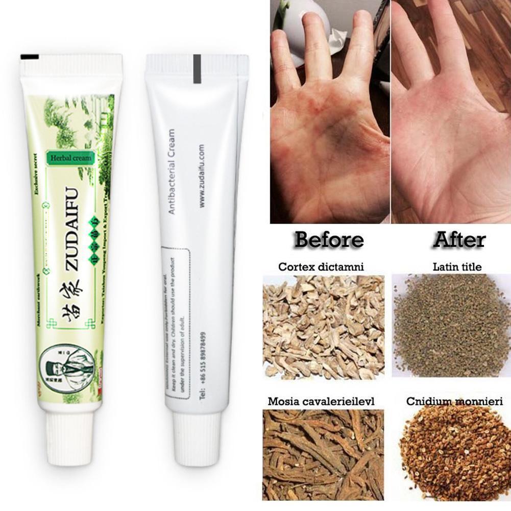Zudaifu Cream Psoriasis Cream Skin Care Psoriasis Skin Dropshipping Dermatitis Eczematoid Eczema Ointment Treatment Care Cream Main image