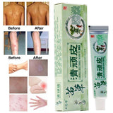 Chinese Herbal Medicine Skin Cream For Anti-itch Allergies Dermatitis Eczema Pruritus Psoriasis Ointment External Use Plaster