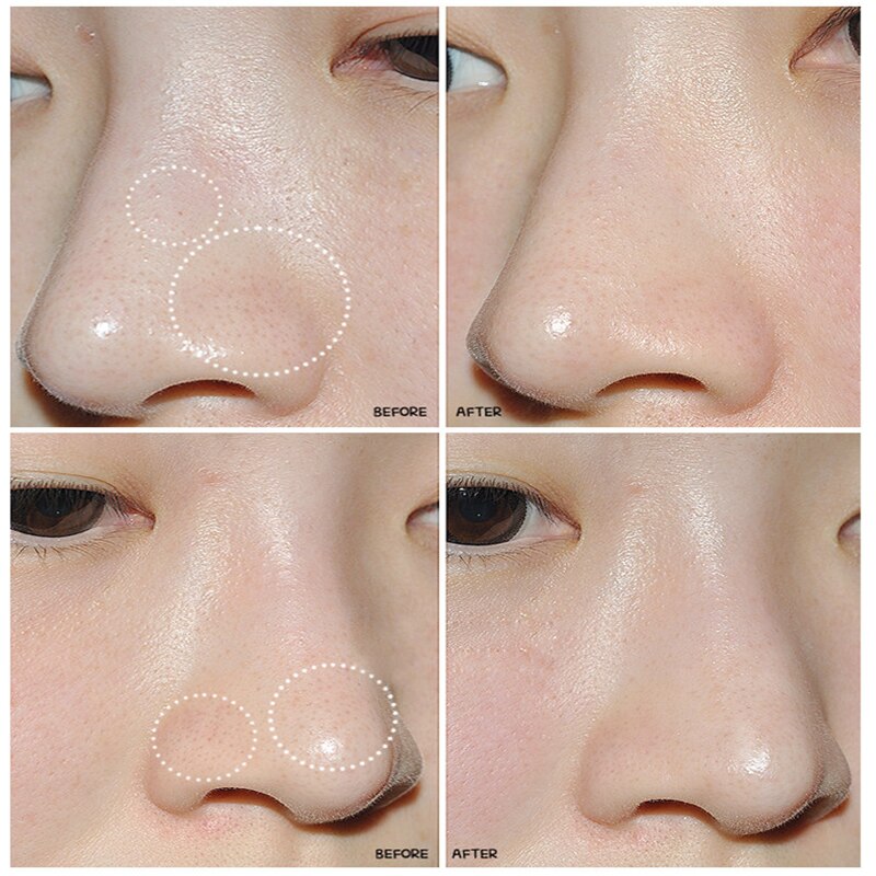 1 PC. Facial Skin Care Head Massage Clean Blackheads Remove Beauticians Pig Nose Acne Mask Stickers 3 Step Kit Black Secondary image