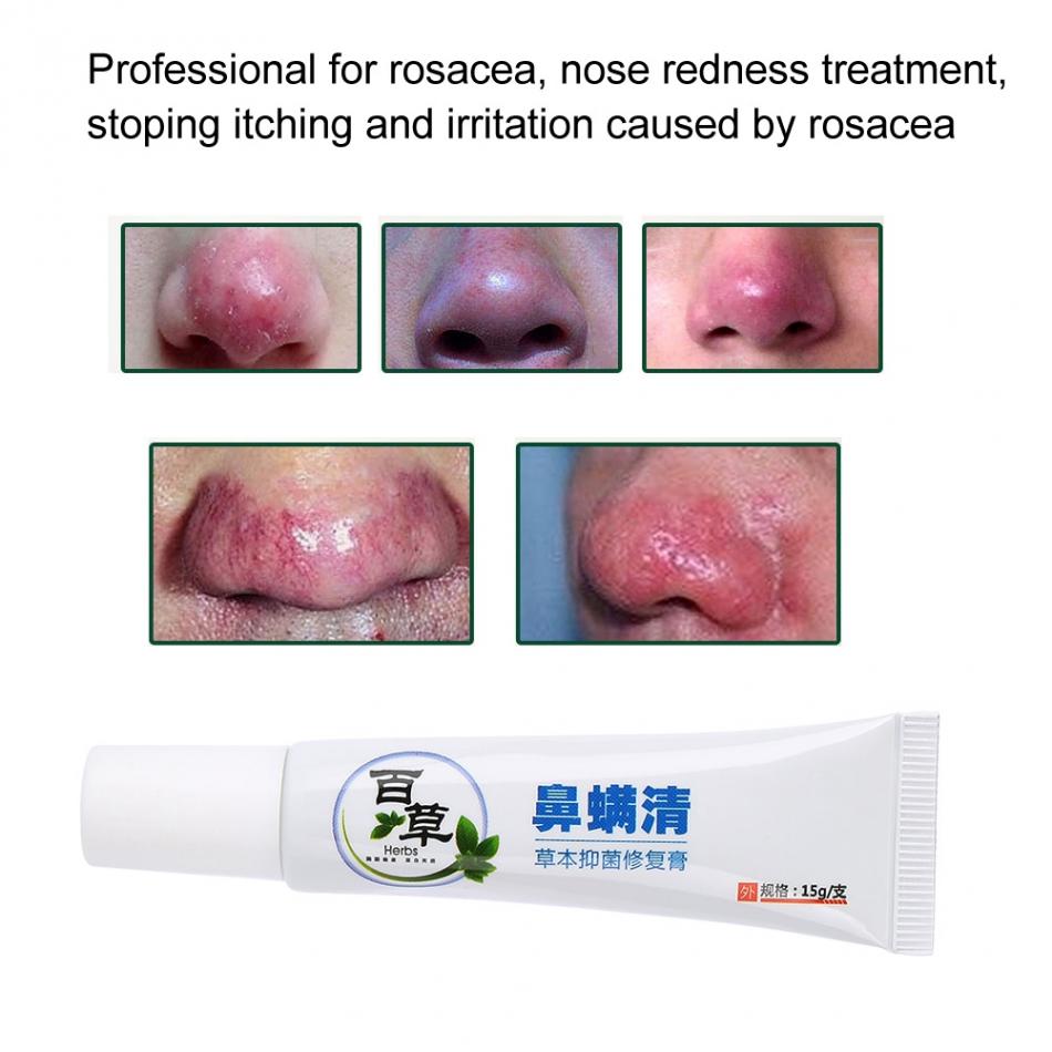 Nose Massage Tools Rosacea Treatment Cream Nose Redness Removal Cleaning Antibacterial Gel Skin Care Product Secondary image