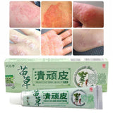 Health psoriasis treatment cream Skin care Dermatitis Eczematoid Eczema Ointment eczema cream psoriasis Itching relief Ointment