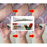 Chinese Medical White Spot Disease Cream Pigment  Vitiligo Leukoplakia Disease Treatment Melanin Promoting Liniment Skin 30g