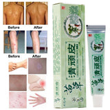 Health psoriasis treatment cream Skin care Dermatitis Eczematoid Eczema Ointment eczema cream psoriasis Itching relief Ointment