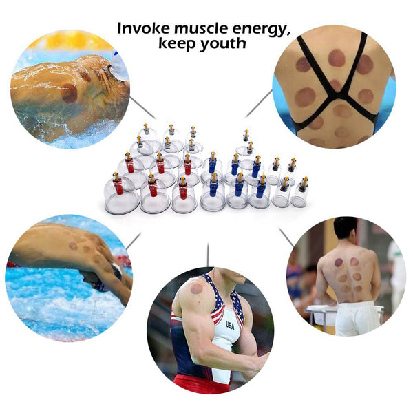 12/24pcs/set Vacuum Cupping Device Suction Cups Medical Sucker Magnetic Treatment Apparatus Banks Body Massage Cans