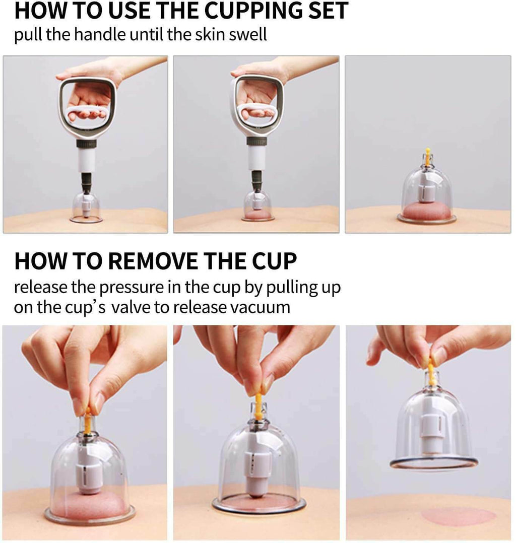 Professional Acupoint Cupping Set, 4th Generation Pump Gun & Cups (24 Cups) 真空拔罐器
