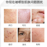 仁和药业 丹参芦荟祛痘凝胶 淡化痘印 祛痘印去痘疤修复Salvia Aloe Acne cream Reduce Scar