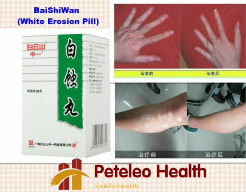 3 Packs BaiShiPills Skin Repigment TCM Therapy BAIYUNSHAN Vitiligo Treatment Main image